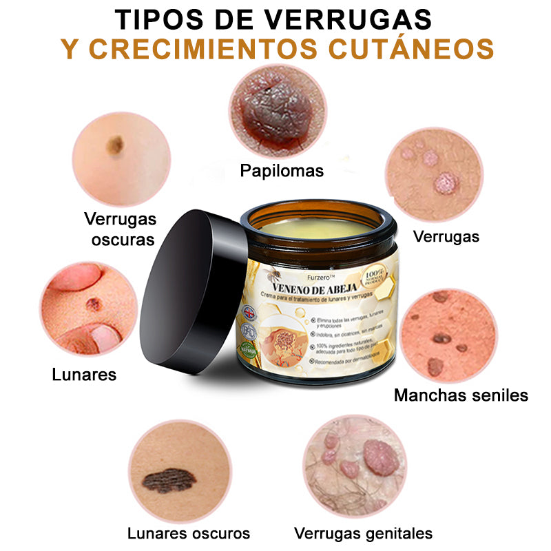 🦜Turonu™ Crema de Tratamiento con Veneno de Abeja (🔥Último día, 80 % de descuento)