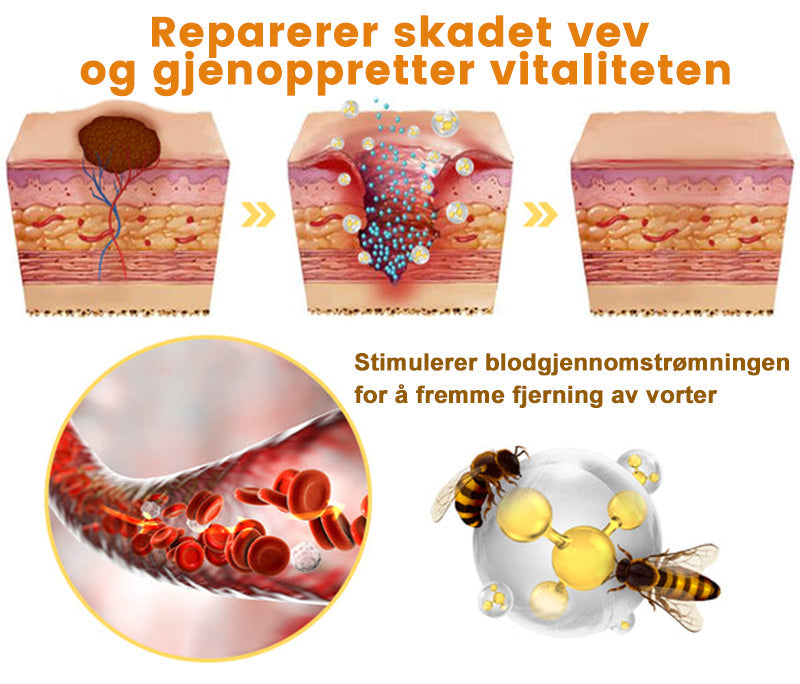 🦍Turoment™ Bie Gift Behandlingskrem (🔥Siste dag, 80 % rabatt)