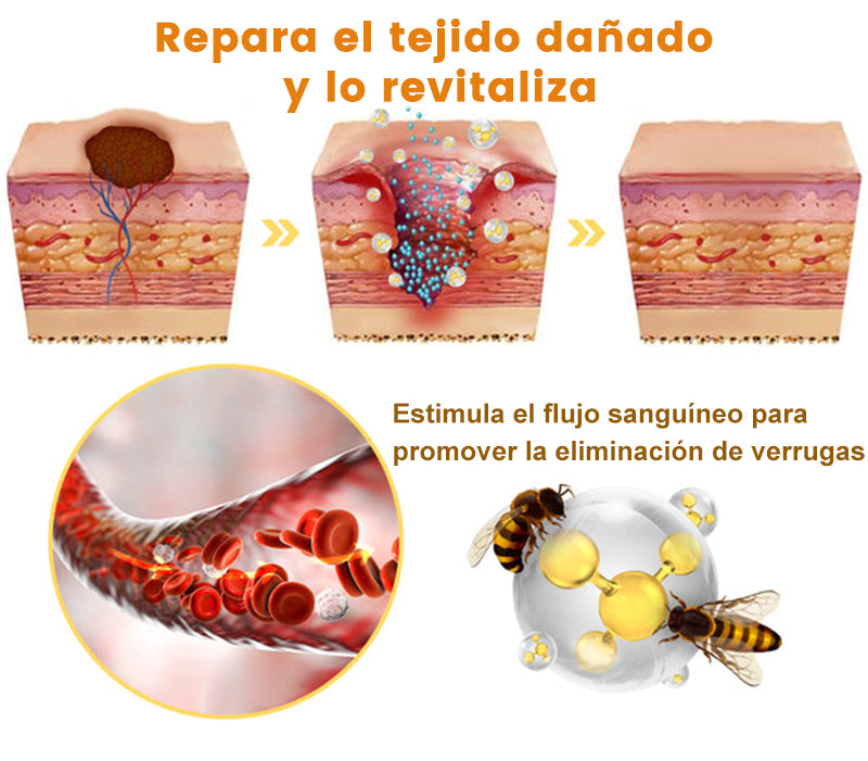 🦜Turonu™ Crema de Tratamiento con Veneno de Abeja (🔥Último día, 80 % de descuento)