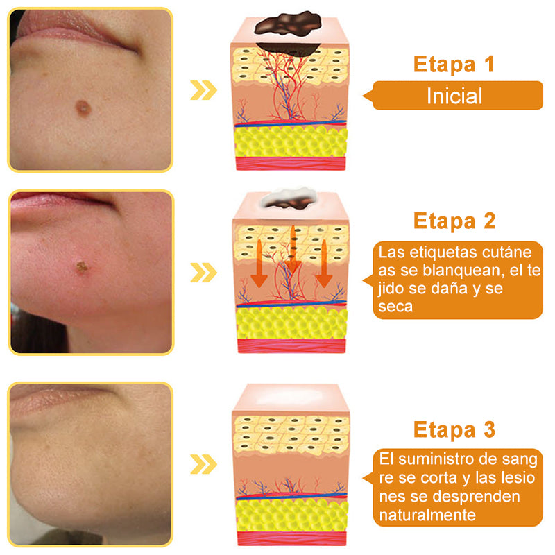 🦜Turonu™ Crema de Tratamiento con Veneno de Abeja (🔥Último día, 80 % de descuento)