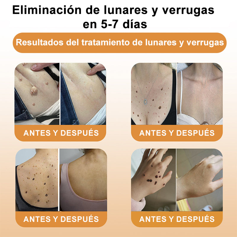 🦜Turonu™ Crema de Tratamiento con Veneno de Abeja (🔥Último día, 80 % de descuento)