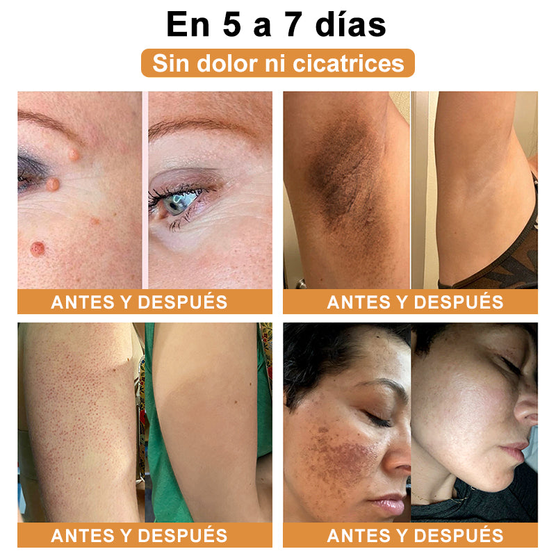 🦜Turonu™ Crema de Tratamiento con Veneno de Abeja (🔥Último día, 80 % de descuento)