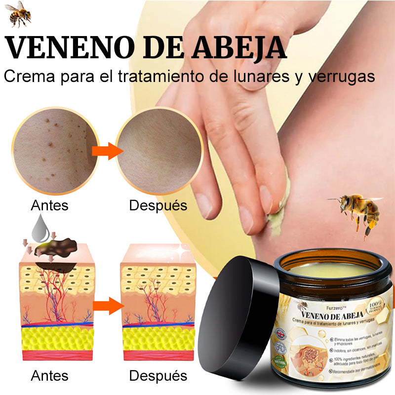 🦜Turonu™ Crema de Tratamiento con Veneno de Abeja (🔥Último día, 80 % de descuento)