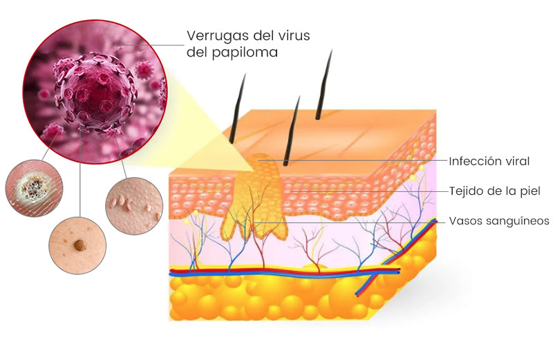 🦜Turonu™ Crema de Tratamiento con Veneno de Abeja (🔥Último día, 80 % de descuento)